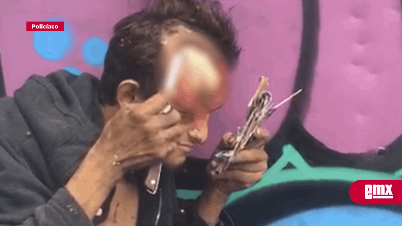 EMX-Con un chuchillo se arranca piel gangrenada de la cabeza en Tijuana 
