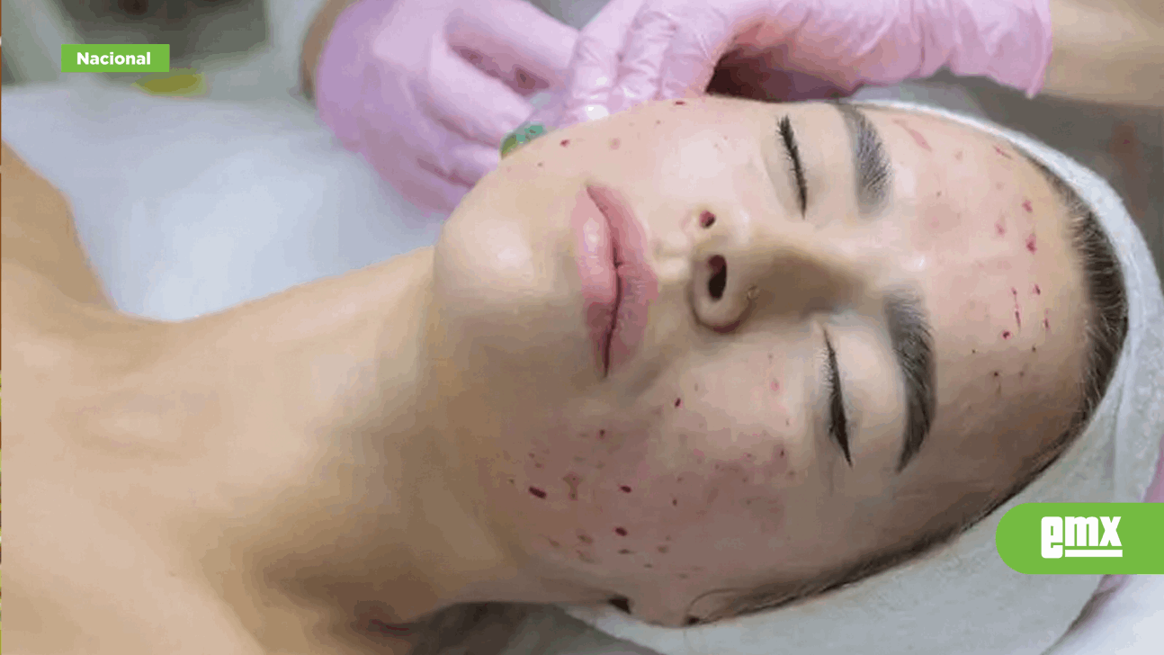 EMX-Tres mujeres contraen VIH tras someterse a extraño tratamiento de belleza 'vampiro facial'